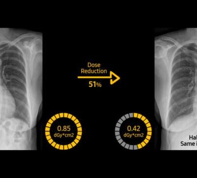 x-ray